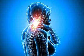 Osteochondrose in der Halsspalte