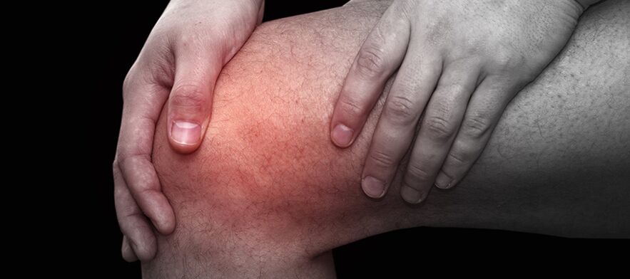 Entzündung und Beschwerden im Knie mit Gonarthrose.