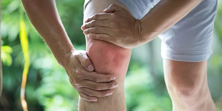Starke Schmerzen bei körperlicher Betätigung aufgrund einer Arthrose des Kniegelenks.